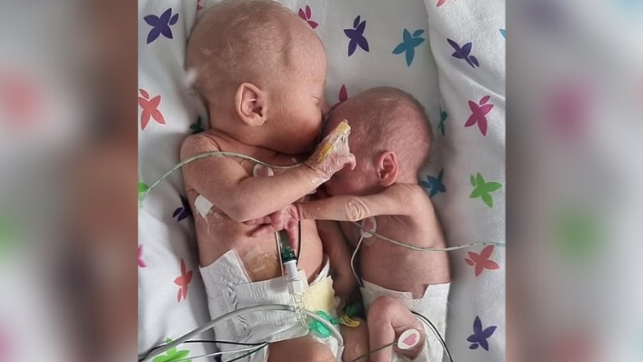 Premature Baby Girl Defies All Odds—Survives to Hug Twin Brother in Viral Photo
