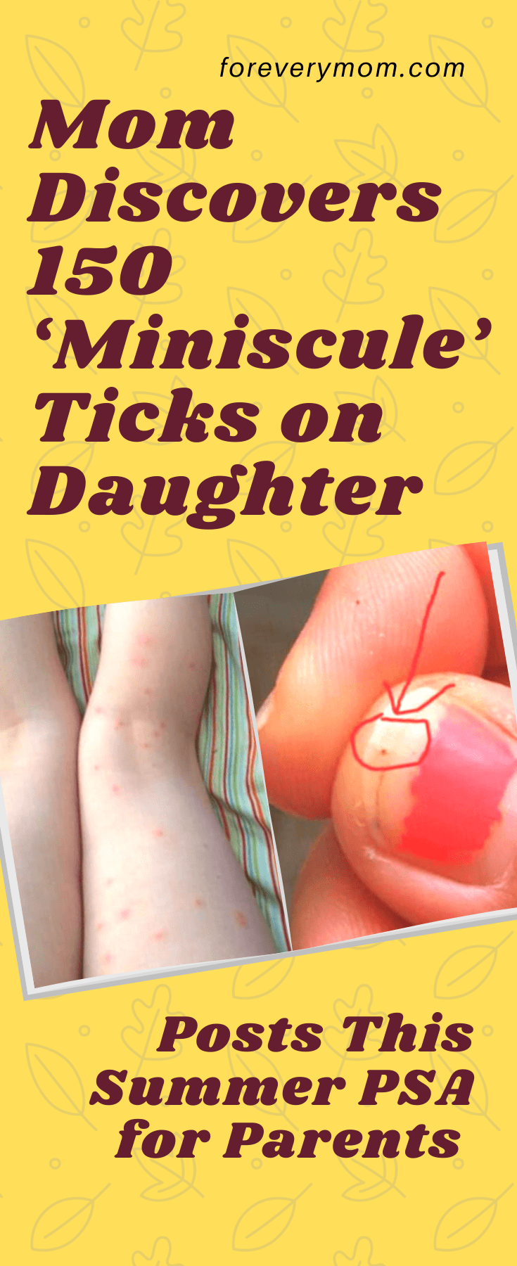 Ticks on Daughter